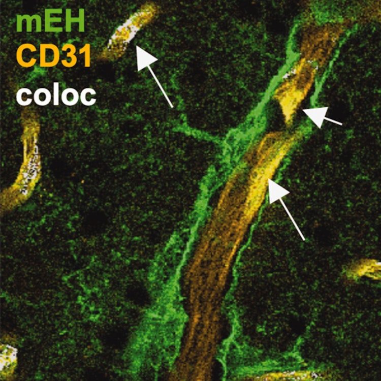 angiogenesis