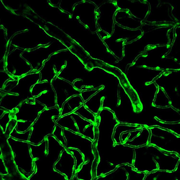microvascular repair