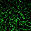 microvascular repair