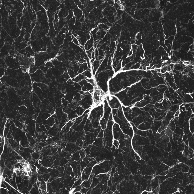 astrocyte
