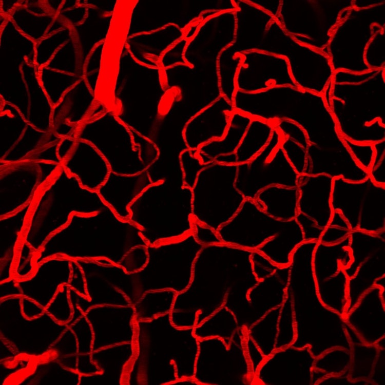 capillary occlusion