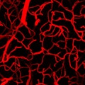 capillary occlusion