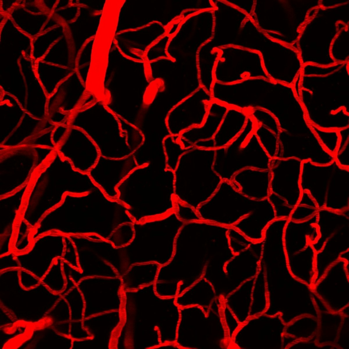 ECgo: All-Optical Induction of Single Endothelial Cell Injury and ...