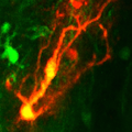 astrocyte repopulation