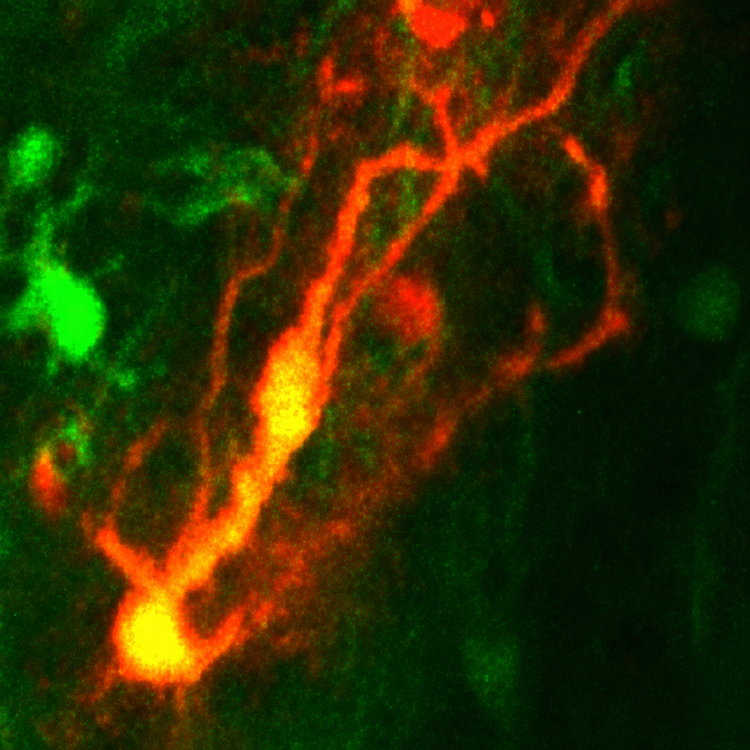 astrocyte repopulation