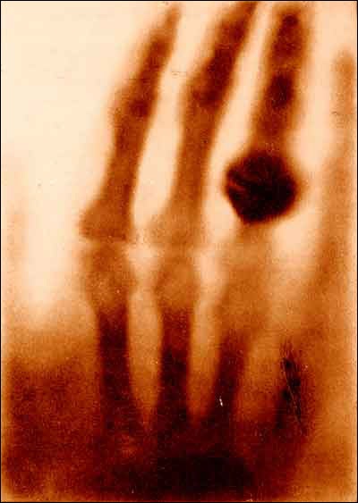 First Computed Radiography Image Developments in medical imaging – timeline