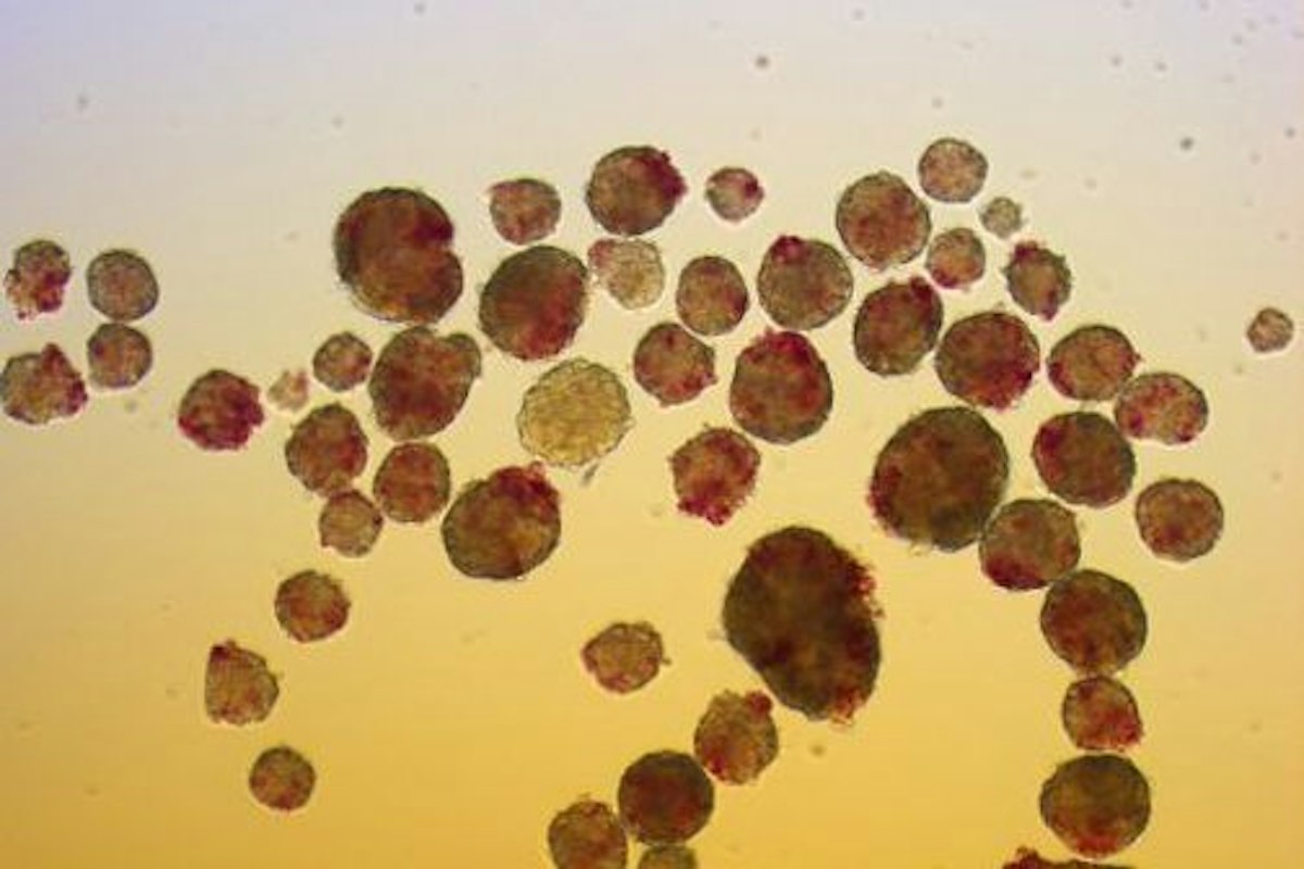 Pig islets stained for purity — Science Learning Hub