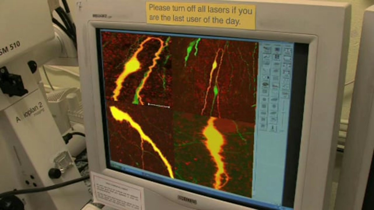 Brain cells in 3D — Science Learning Hub