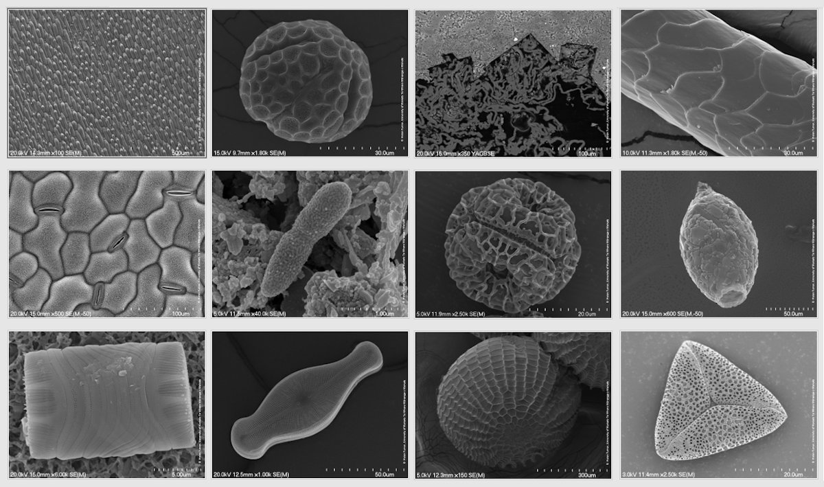 Electron microscope images – slideshow
