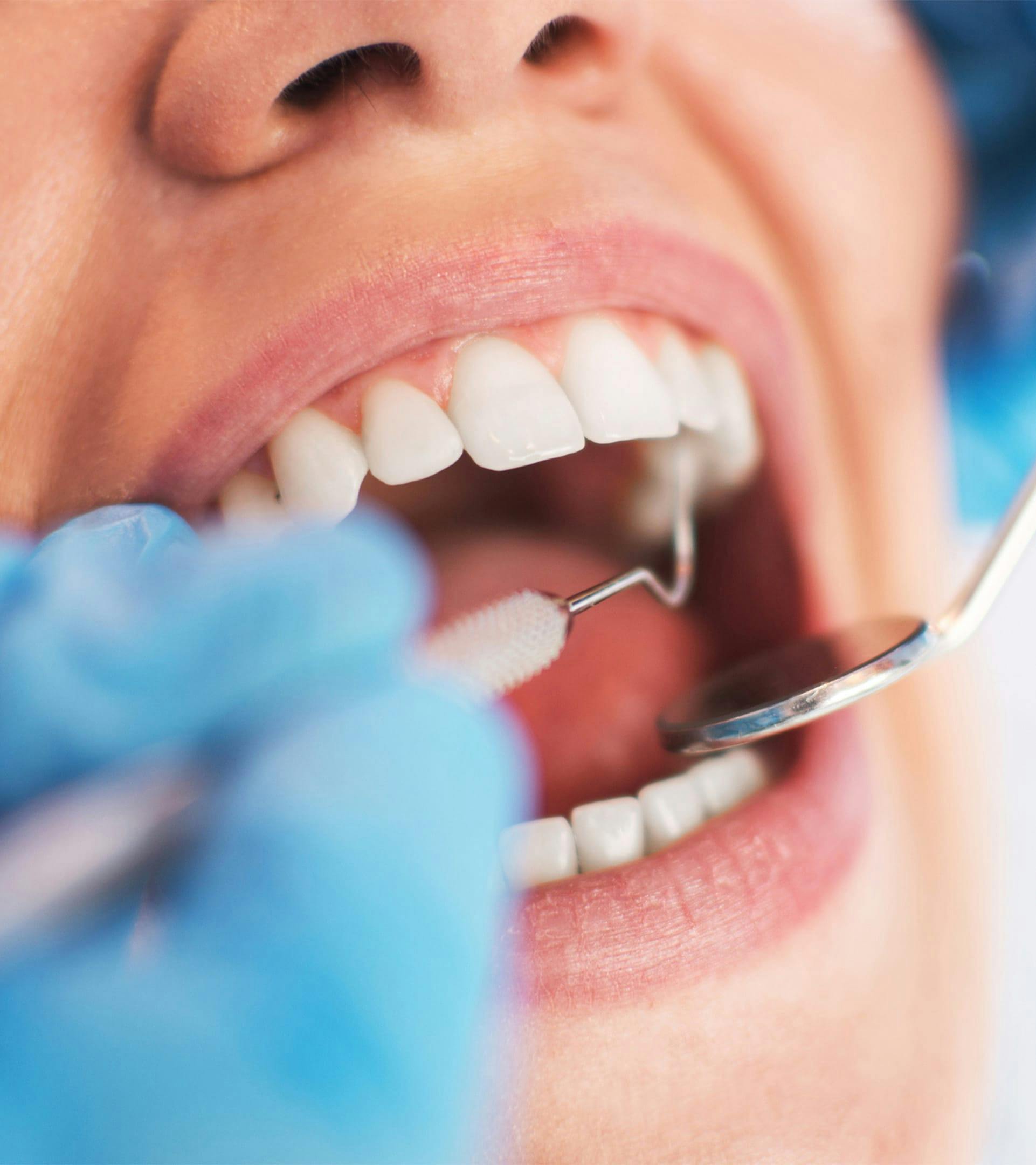 patient getting their teeth examined
