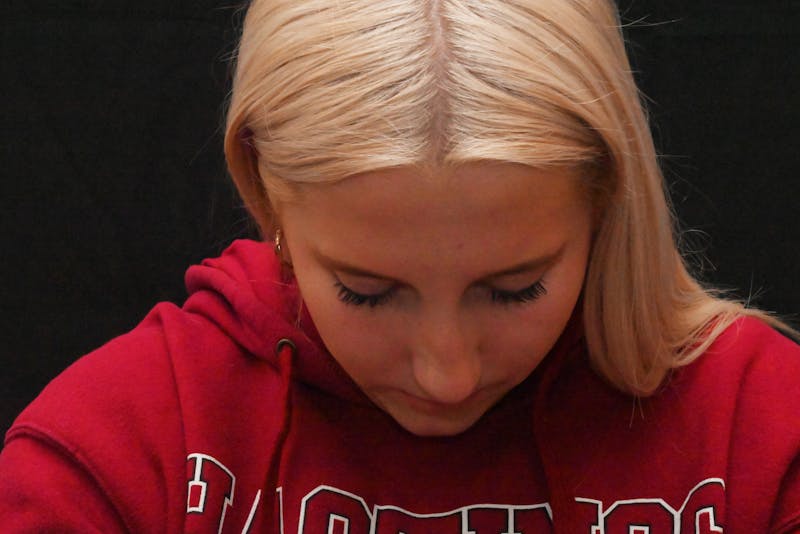 Rhinoplasty Before & After Gallery - Patient 652045 - Image 3