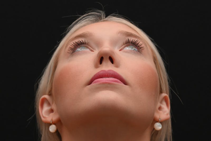 Rhinoplasty Before & After Gallery - Patient 157160 - Image 13