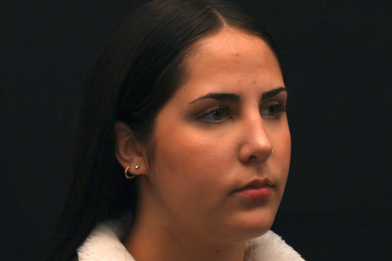 Rhinoplasty Before & After Gallery - Patient 603855 - Image 6