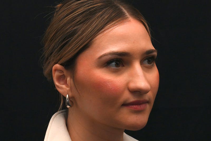 Rhinoplasty Before & After Gallery - Patient 257776 - Image 6