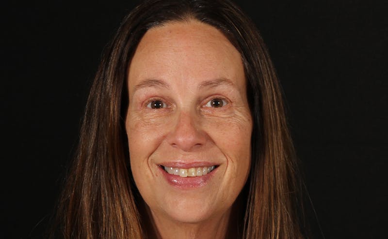 Blepharoplasty & Browlift Before & After Gallery - Patient 224767 - Image 2