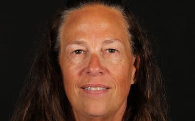 Blepharoplasty & Browlift Before & After Gallery - Patient 224767 - Image 1