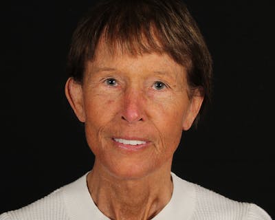 Face & Neck Lift Before & After Gallery - Patient 907652 - Image 2