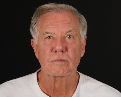 Laser Treatments Before & After Gallery - Patient 409738 - Image 2