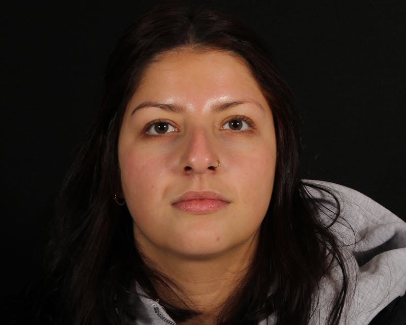 Rhinoplasty Female Before & After Gallery - Patient 316760 - Image 5