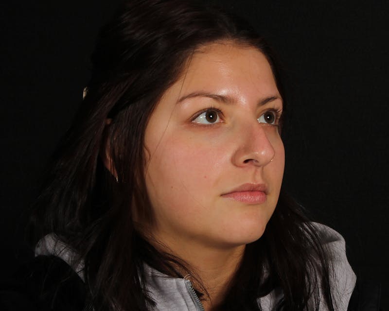 Rhinoplasty Female Before & After Gallery - Patient 316760 - Image 9