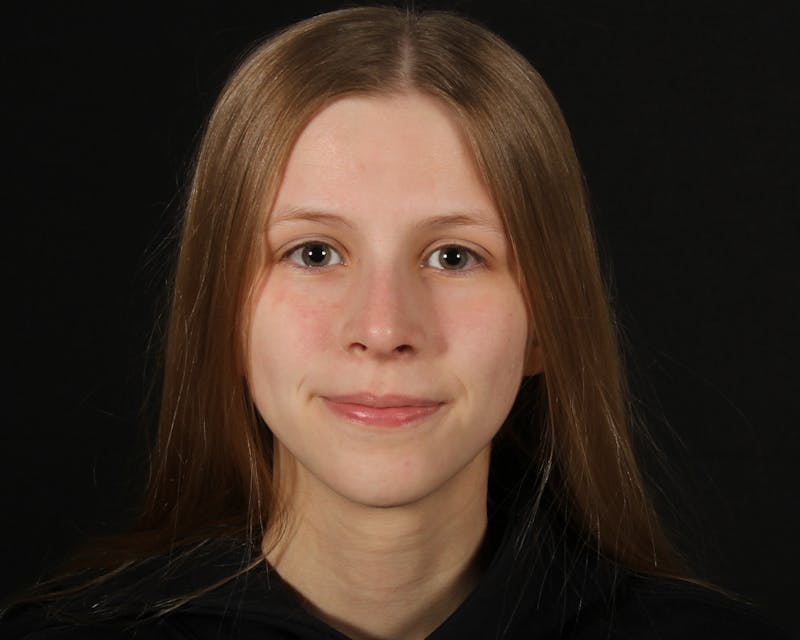 Rhinoplasty Female Before & After Gallery - Patient 223428 - Image 6