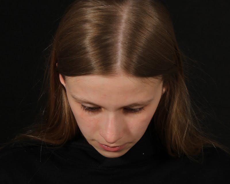 Rhinoplasty Female Before & After Gallery - Patient 223428 - Image 8