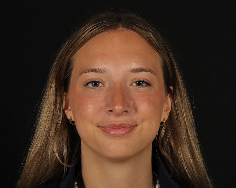 Rhinoplasty Female Before & After Gallery - Patient 131093 - Image 6