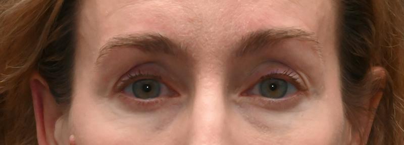 CC Before