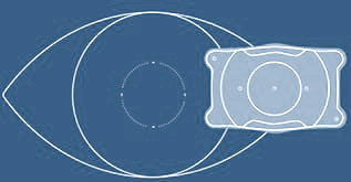 evo visian icl diagram