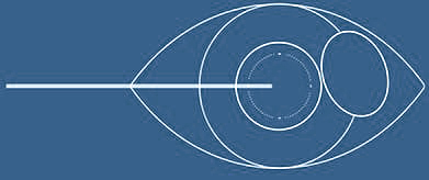 lasik diagram