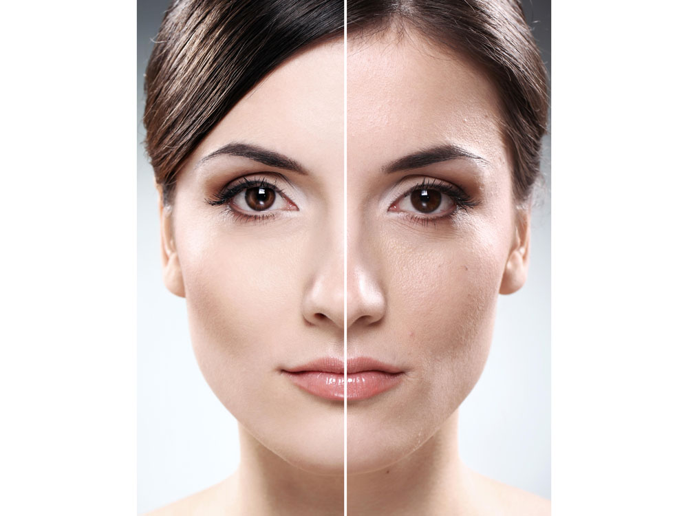 Dry Eyes After LASIK Surgery - Dello Russo Laser Vision