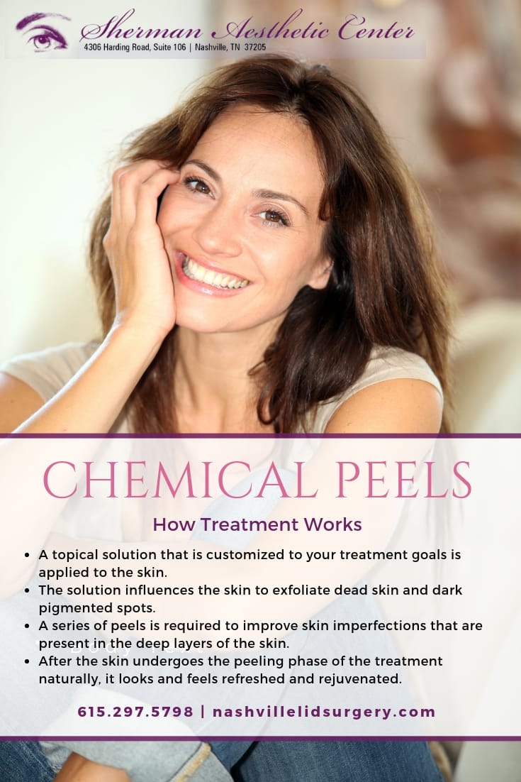 chemical peels promotional banner