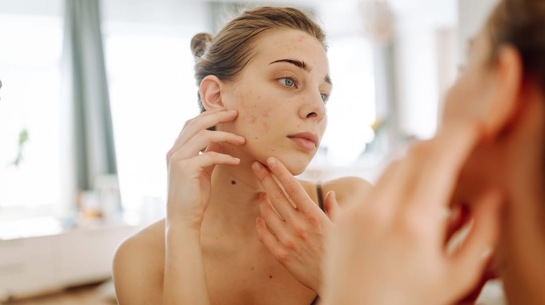 woman inspecting face in mirror