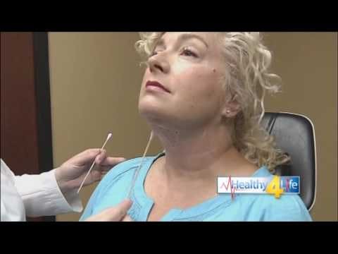 kybella patient