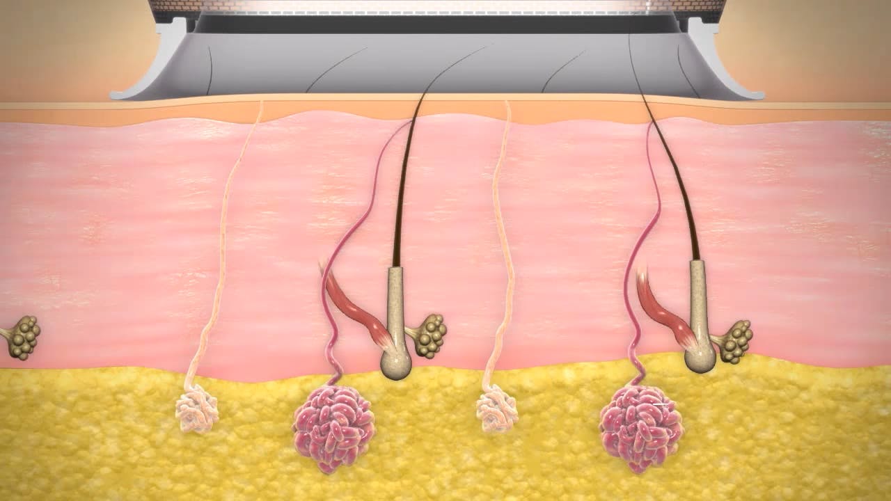 hair follicle diagram