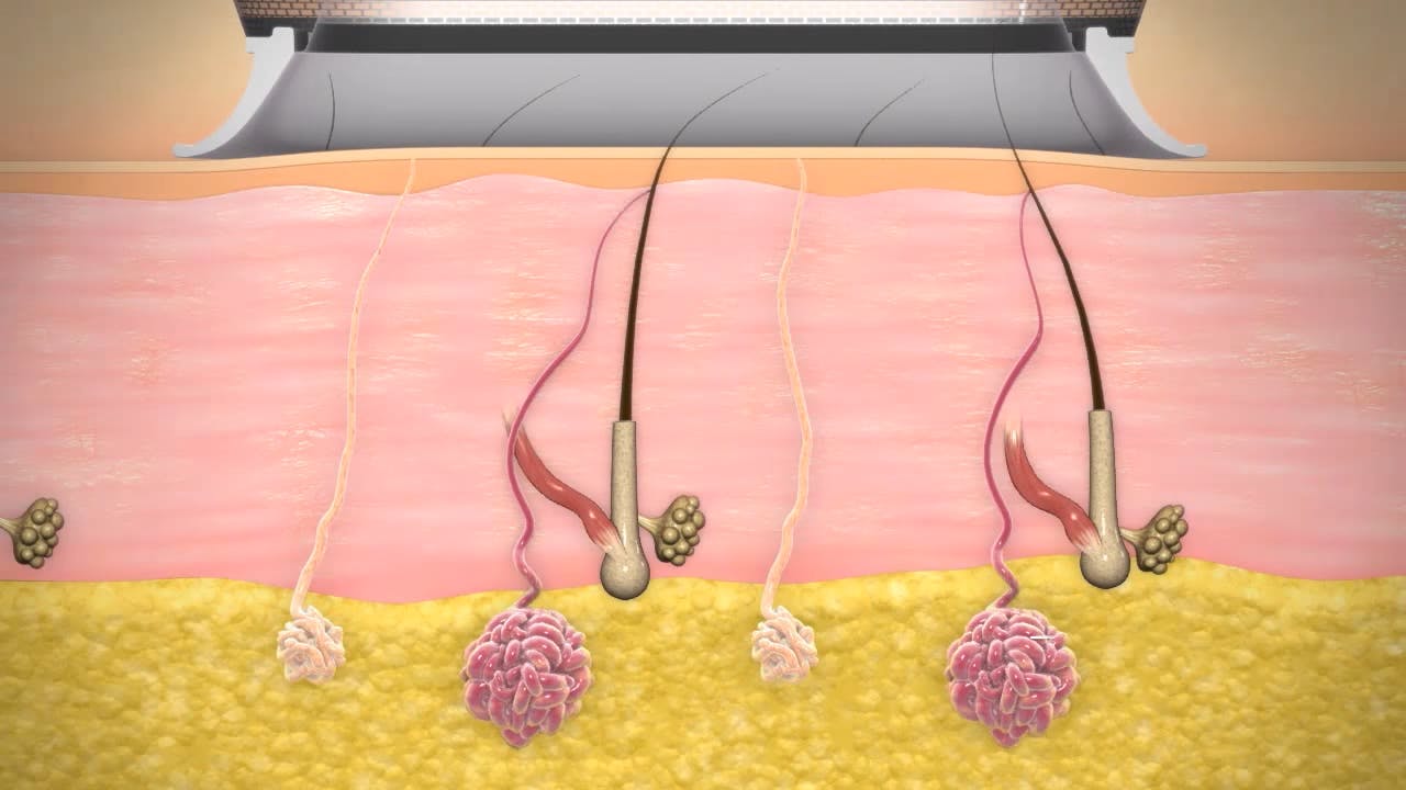 hair follicle diagram