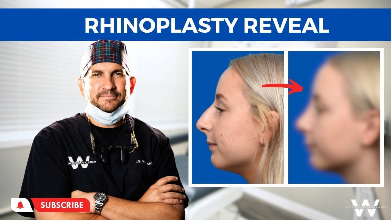 Rhinoplasty reveal banner