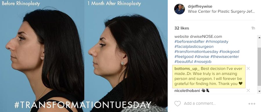 B&A Instagram post