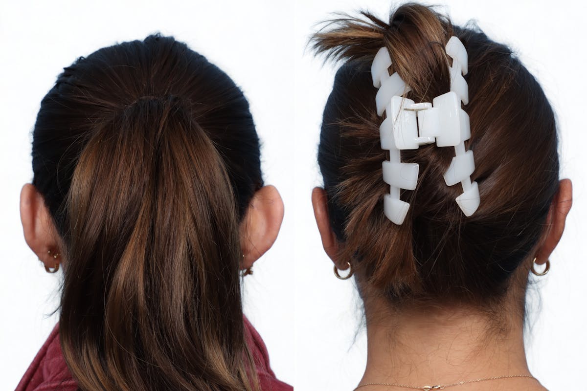 Otoplasty (Ear Surgery) Before & After Gallery - Patient 355354 - Image 1