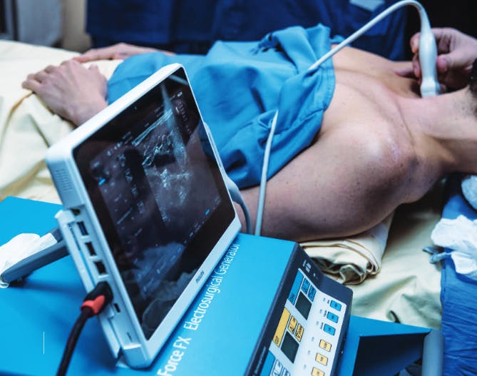 Man receiving radio frequency treatment