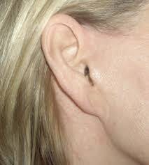 Pixie Ears