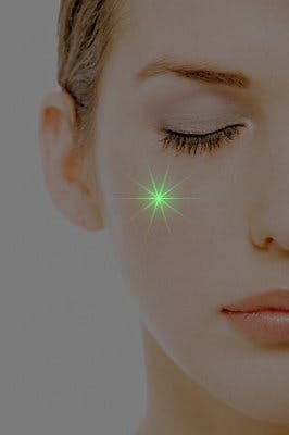 Green laser for facial redness