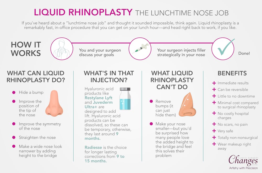 Liquid rhinoplasty infographic