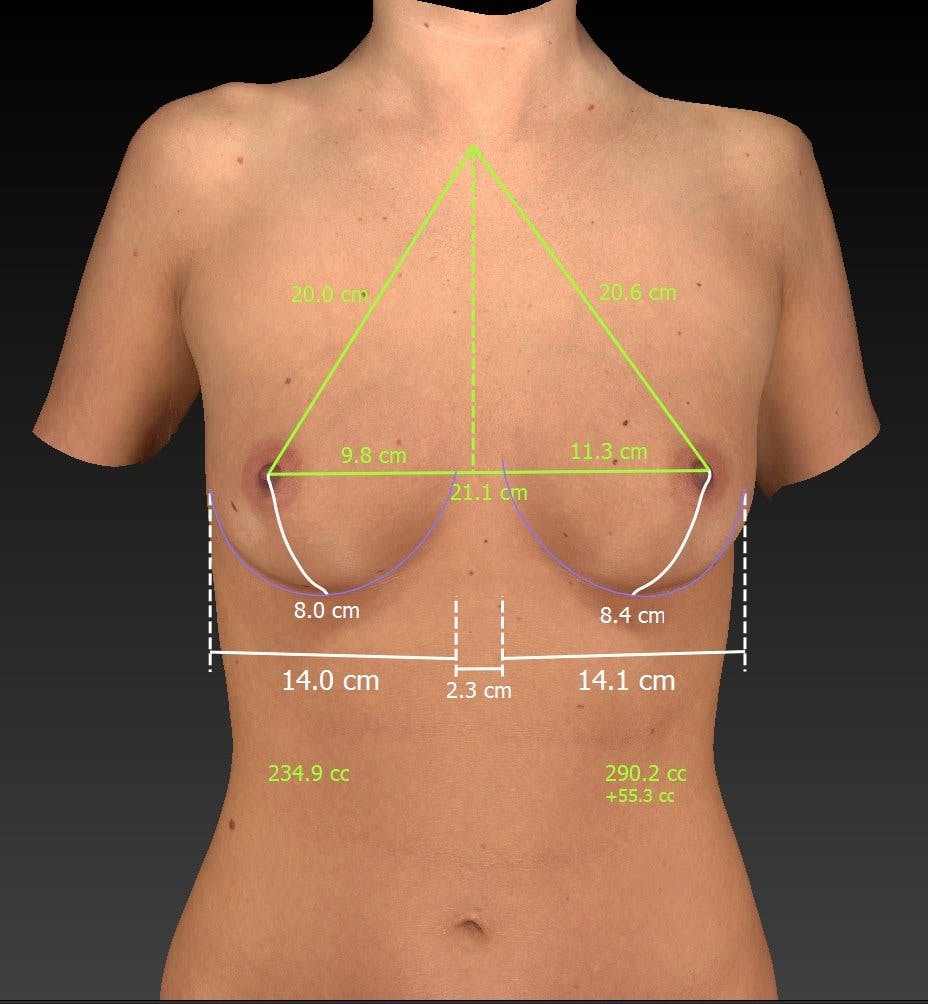 breast assessment