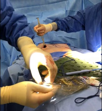 Dr. Lee performing surgery