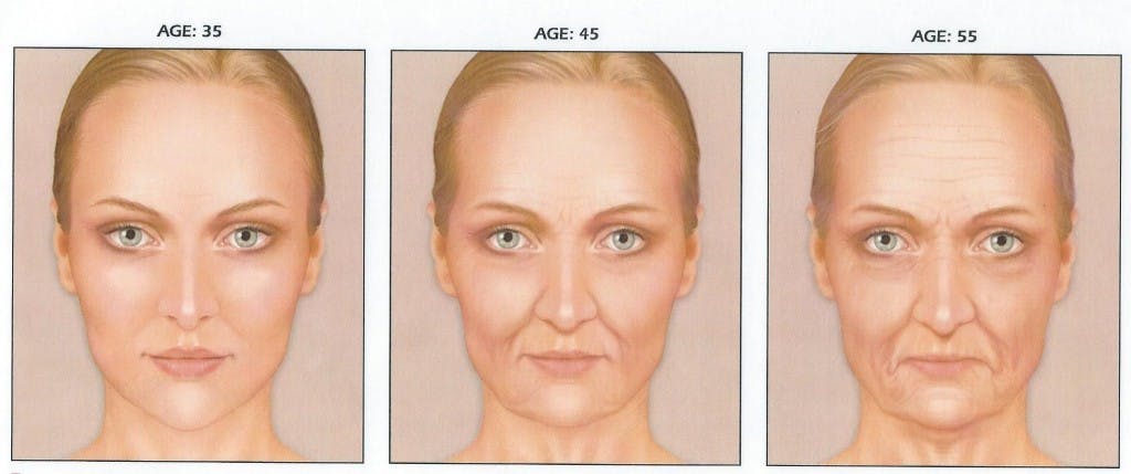 Skin Aging