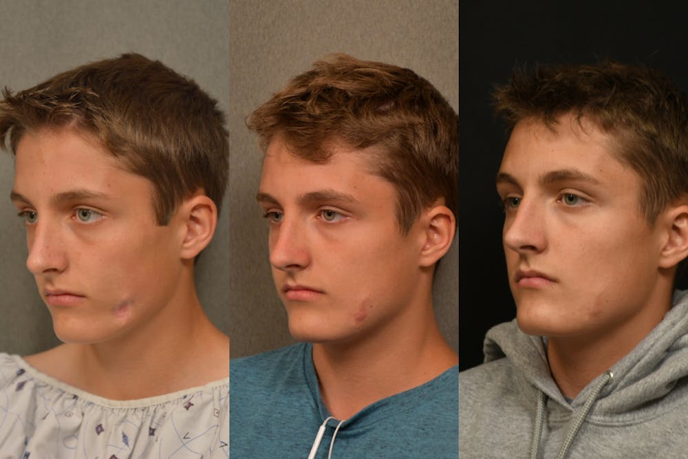 3 images of man with scars fading away