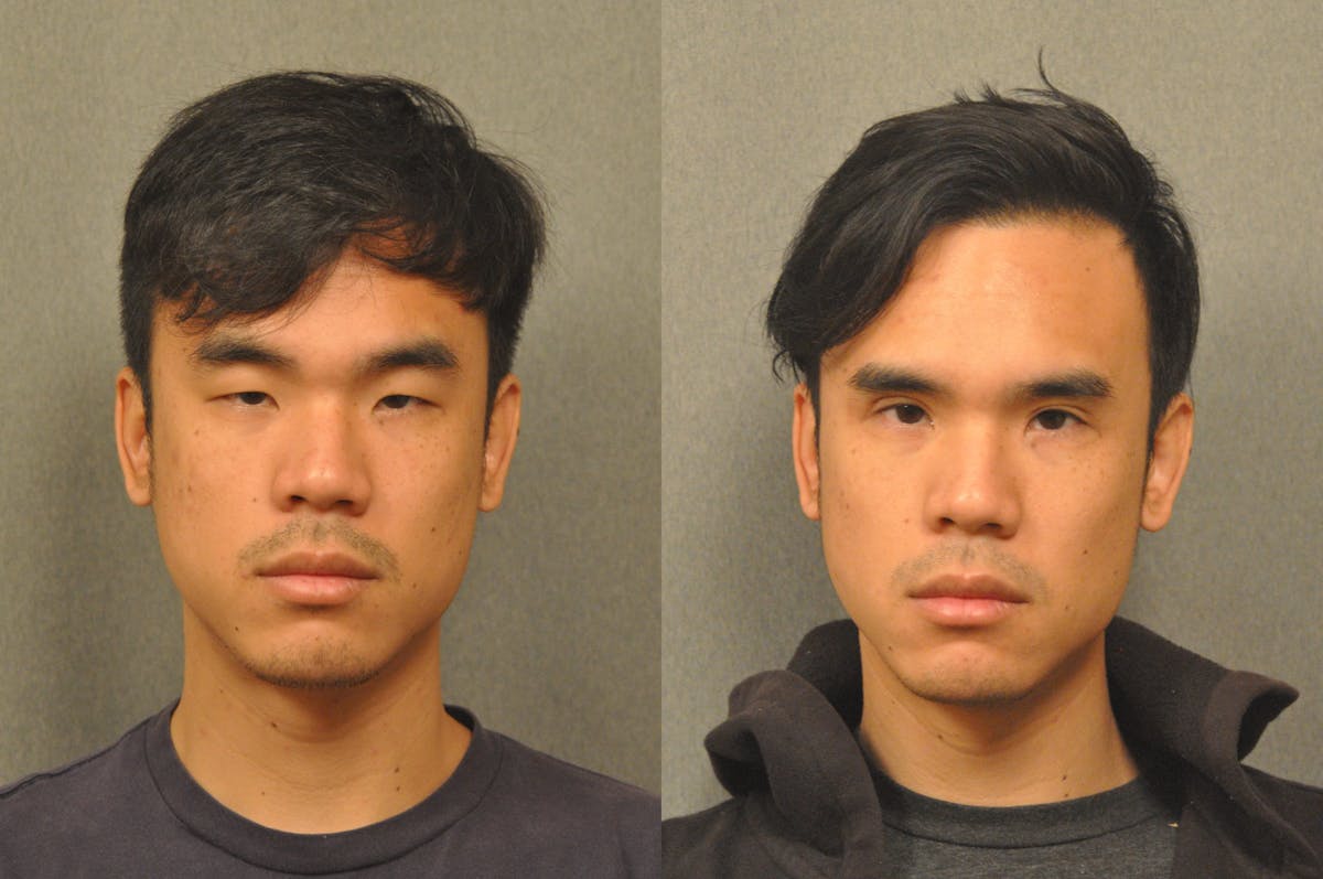 Asian Double Fold Before & After Gallery - Patient 709361 - Image 5