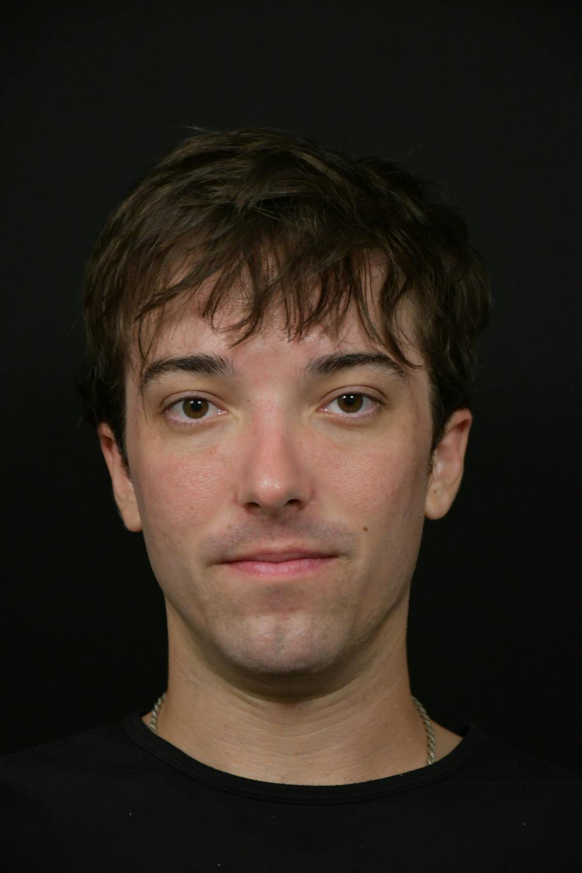 Skin Rejuvenation Before & After Gallery - Patient 314208 - Image 6