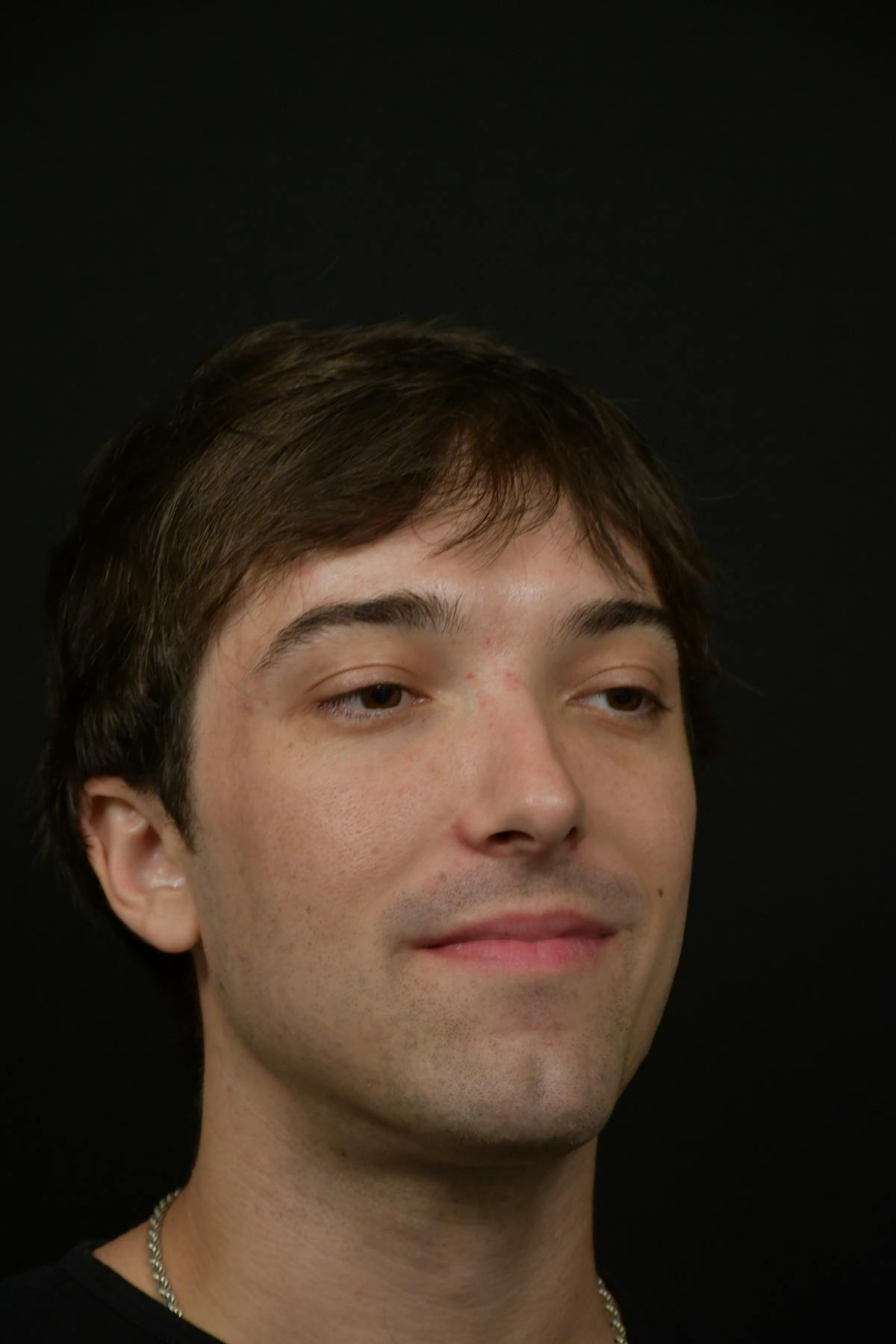 Skin Rejuvenation Before & After Gallery - Patient 314208 - Image 4